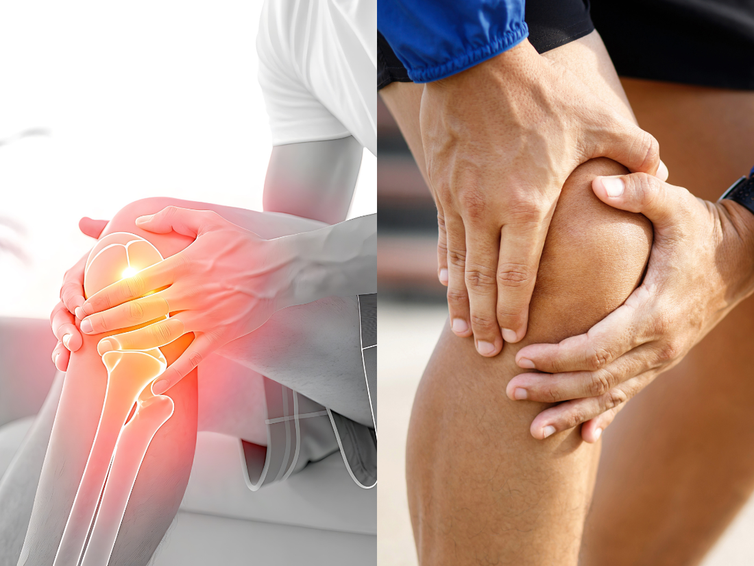 Knee Pain; Simple Remedies for Active People