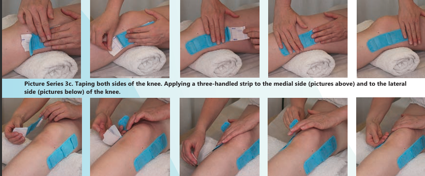 6D TAPE® - The Evolution of Taping Technology