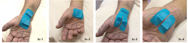 6D Tape: Therapy Tape with Manipulation Handles - Frequently Asked Questions