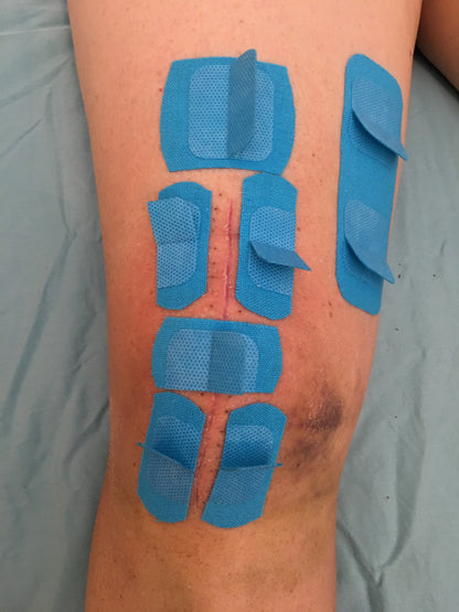 6D Tape® - Therapy Tape with Mobilization Handles