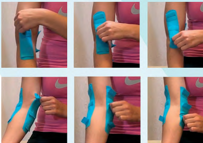 6D Tape® | Vendaje Terapéutico con Asas de Movilización
