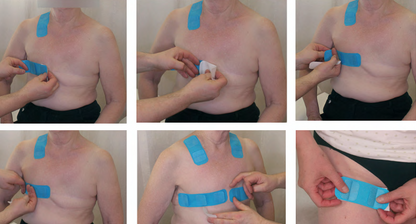 6D Tape® | Vendaje Terapéutico con Asas de Movilización